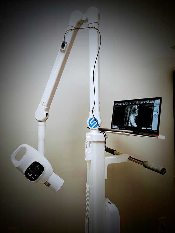 Dental X-ray Dental X-ray